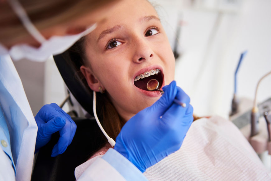 Don't Want Wired Braces This School Year? Check Out the Clearer Option Don't Want Wired Braces This School Year? Check Out the Clearer Option